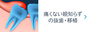 痛くない親知らずの抜歯・移植