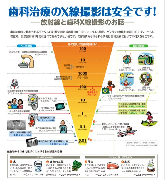 レントゲンについて